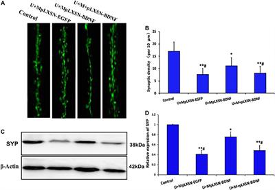 Ultrasound Combined With Microbubbles Loading BDNF Retrovirus to Open Blood–Brain Barrier for Treatment of Alzheimer’s Disease